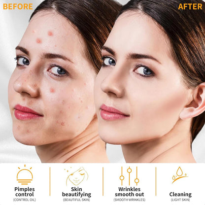 High Frequency Electrotherapy Neon Facial Skin Massage Wand