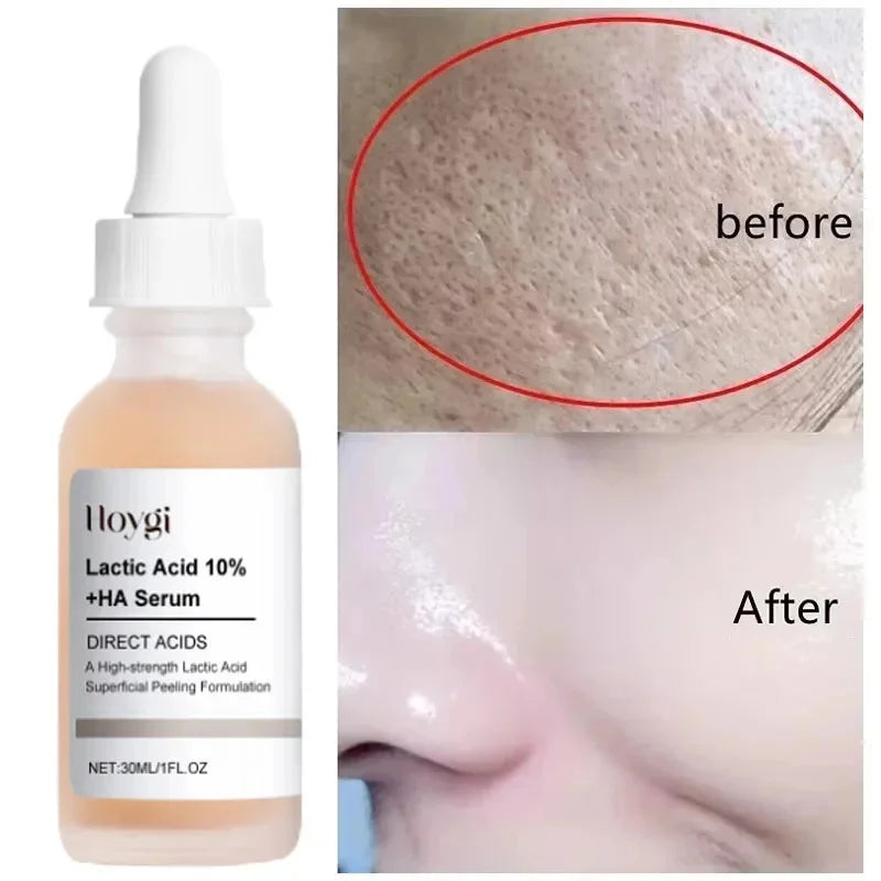 Lactic Acid Shrink Pores Serum Fast Large Pores Removal