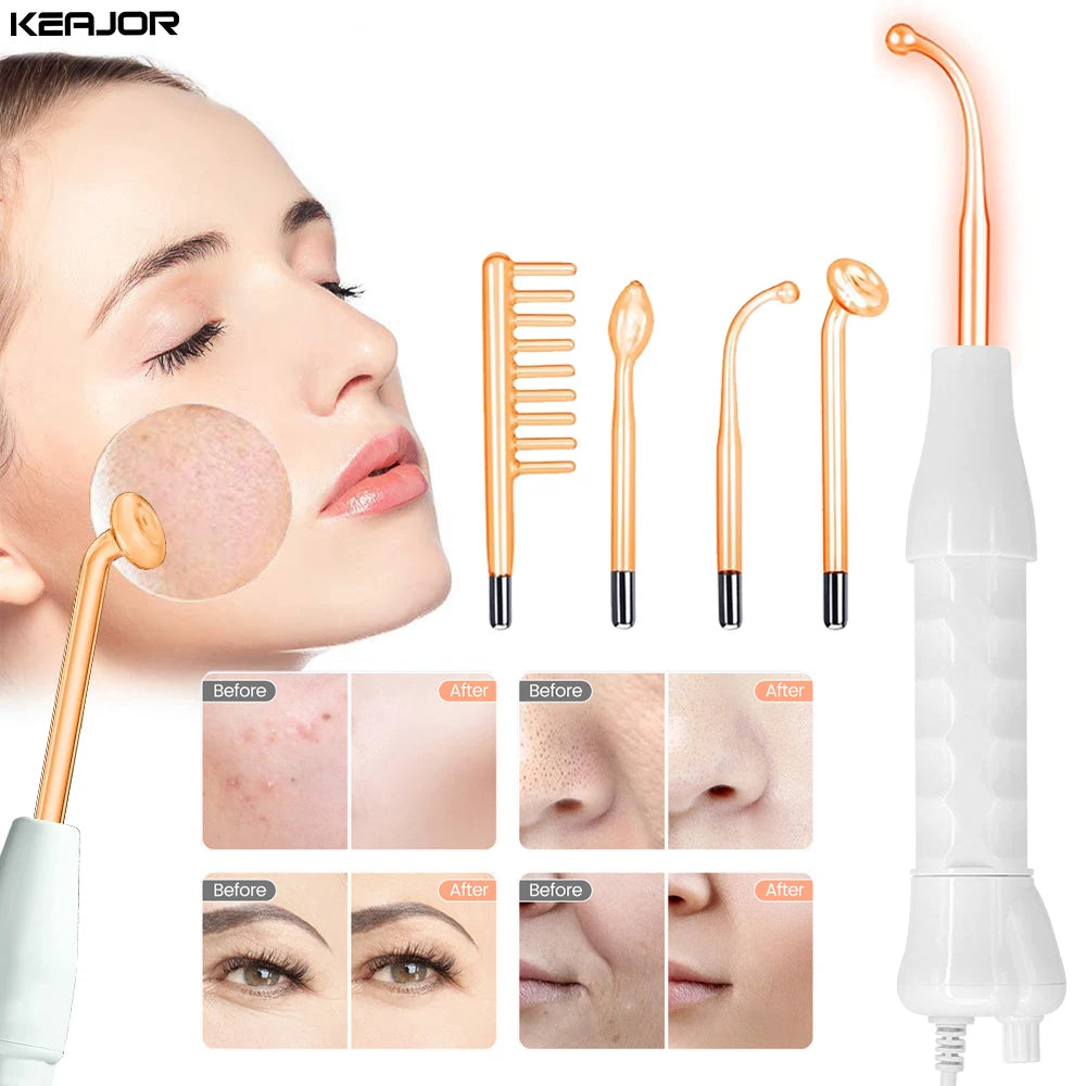 High Frequency Electrotherapy Neon Facial Skin Massage Wand