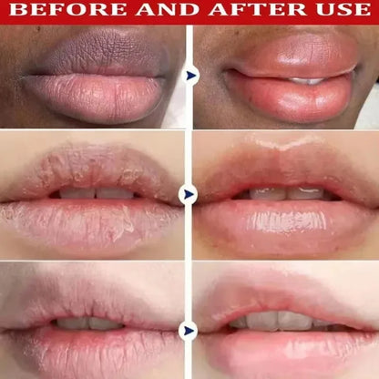 Fast Remove Dark Lip Balm Serum Lighten Melanin