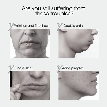 Face Lifting Device Red Light Skin Rejuvenation V Face