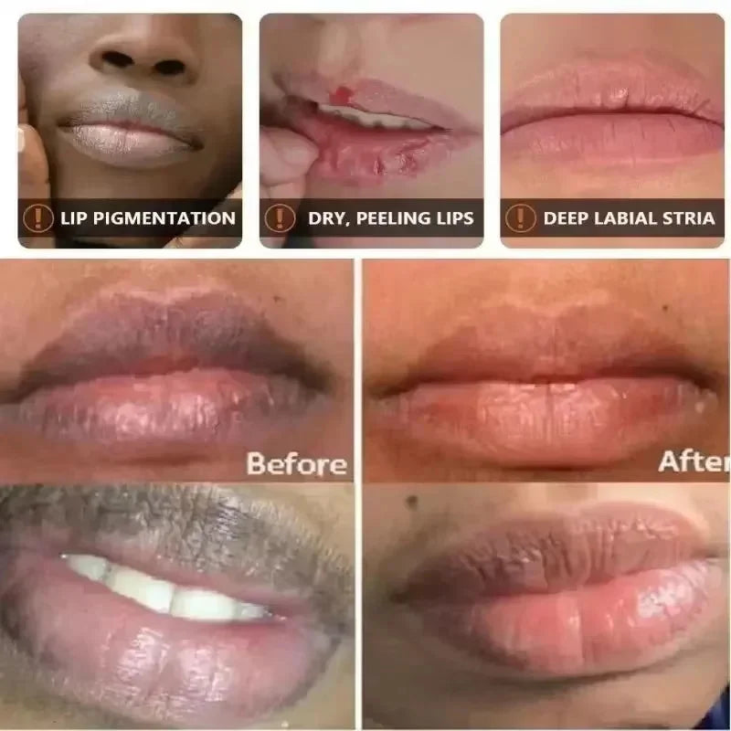 Fast Remove Dark Lip Balm Serum Lighten Melanin