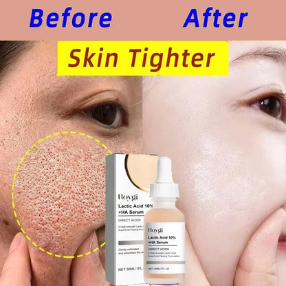 Lactic Acid Shrink Pores Serum Fast Large Pores Removal