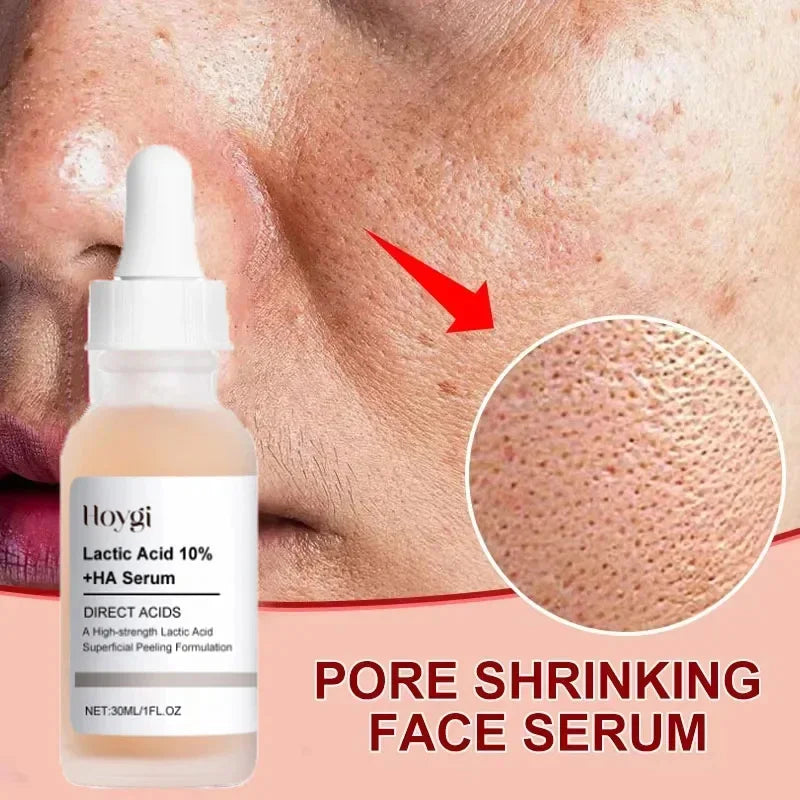 Lactic Acid Shrink Pores Serum Fast Large Pores Removal