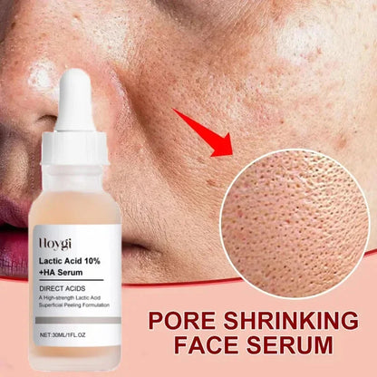 Lactic Acid Shrink Pores Serum Fast Large Pores Removal